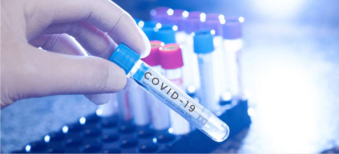covid-19-vial