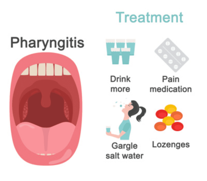 pharyngitispic