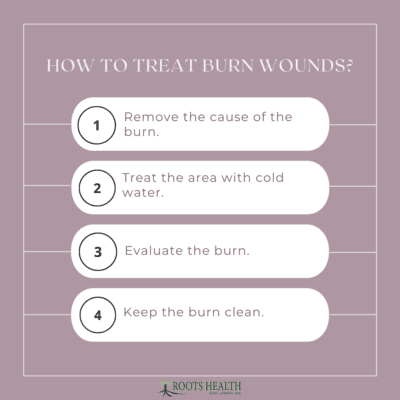 HOW TO TREAT BURN WOUNDS